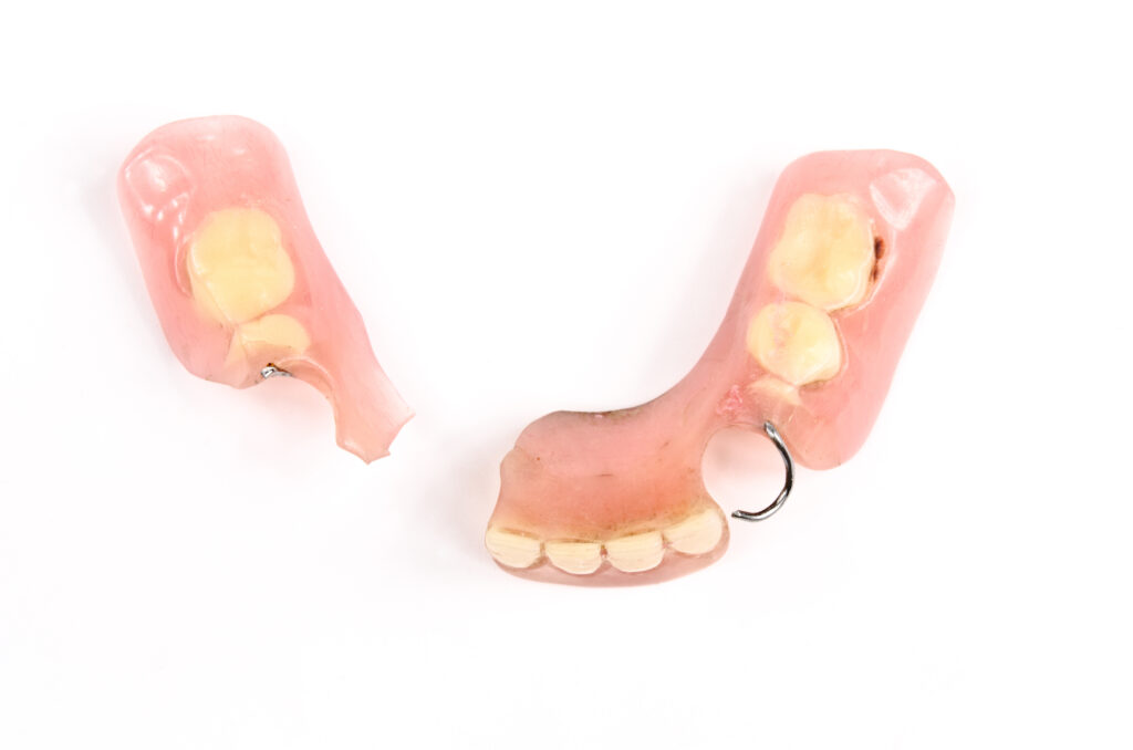 Broken partial dentures